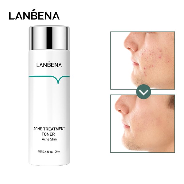 Новый LANBENA для лечения акне успокаивает кожу, глубоко увлажняет, осветляет кожу восстановление лица, противовоспалительный Тонер для лица